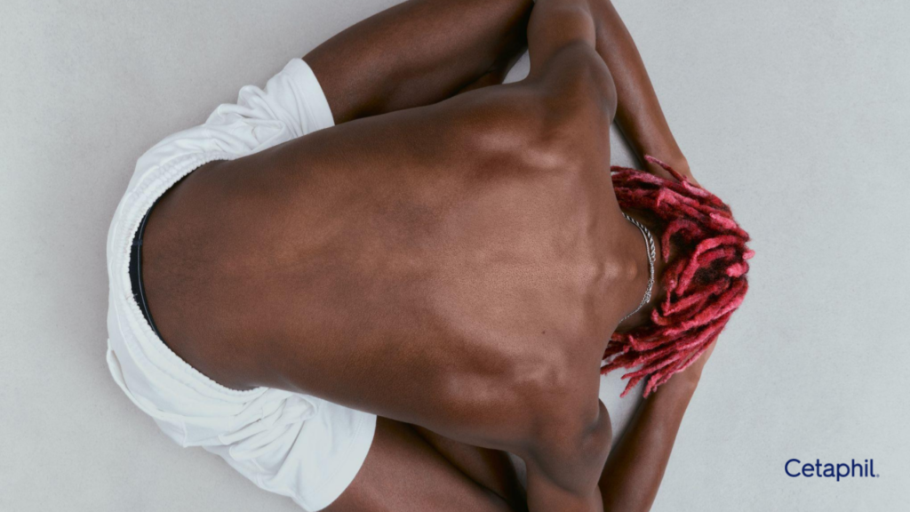 Que es piel sensible.pptx (11)