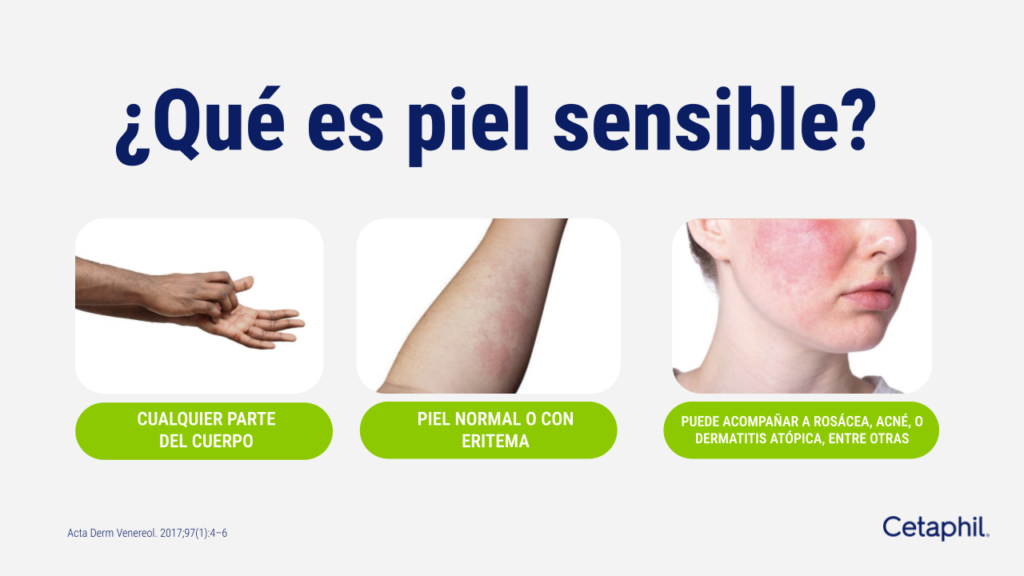 Que es piel sensible.pptx (2)